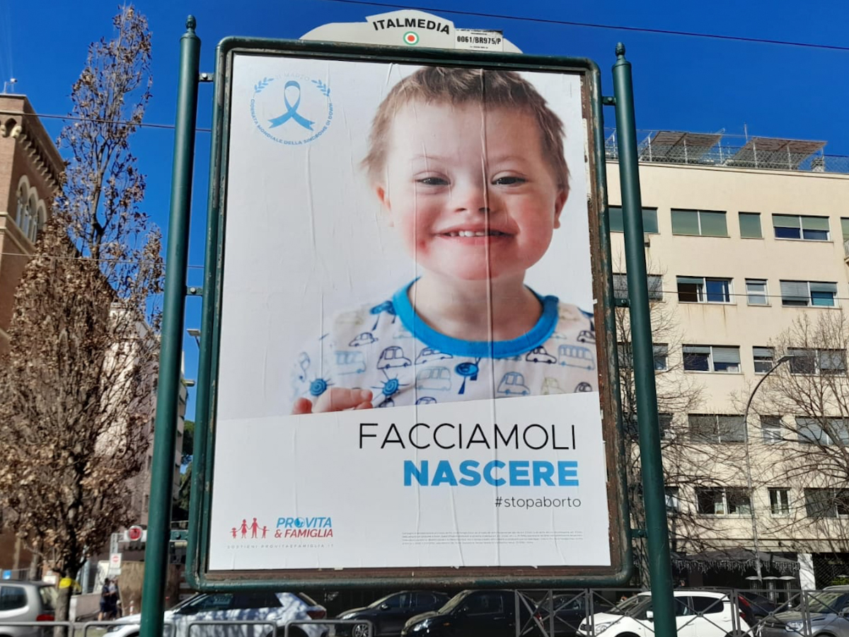 Trisomia 21: possibile causa in una reazione autoimmune 1